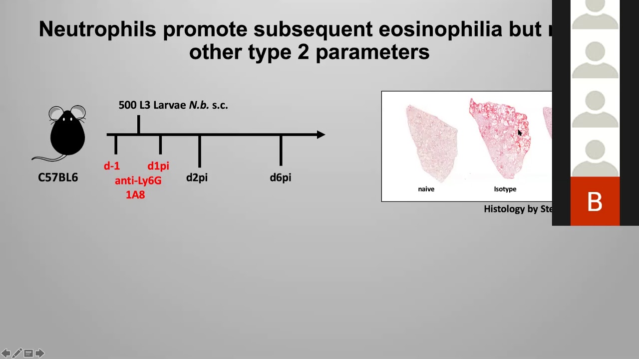 [Jesuthas Ajendra] IL-17A both initiates, via IFN&gamma; suppression, and limits the pulmonary type-2...