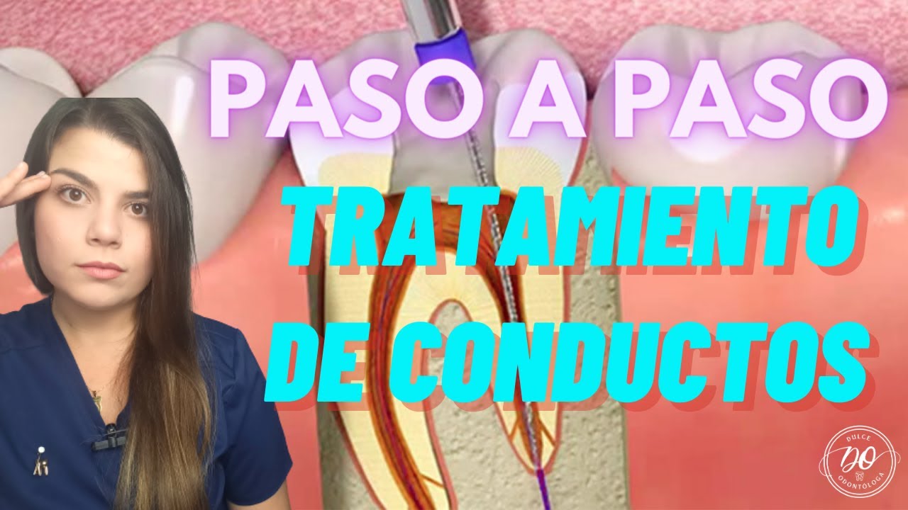 Como se hace un TRATAMIENTO DE CONDUCTO 🦷en 7 PASOS ✅