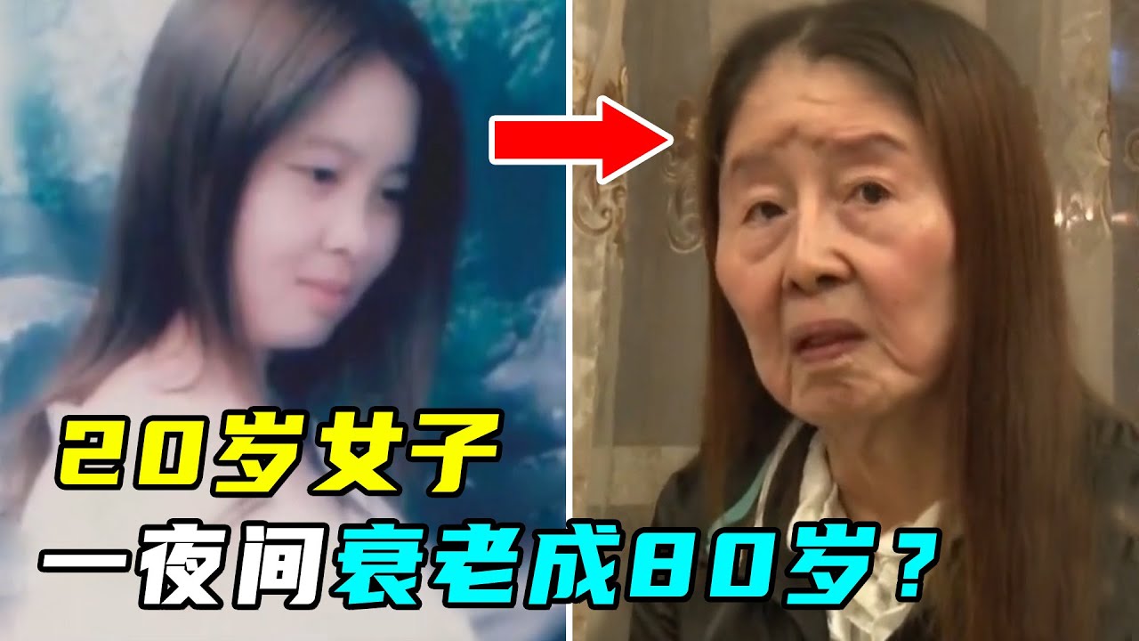 20岁宝妈生娃后，一夜衰老成80岁，专家：全球仅10例
