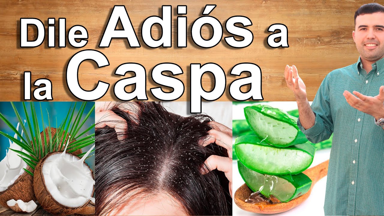 LA CASPA, SUS CAUSAS Y COMO ELIMINARLA DE MANERA NATURAL - Remedios Caseros Para Eliminar la Caspa
