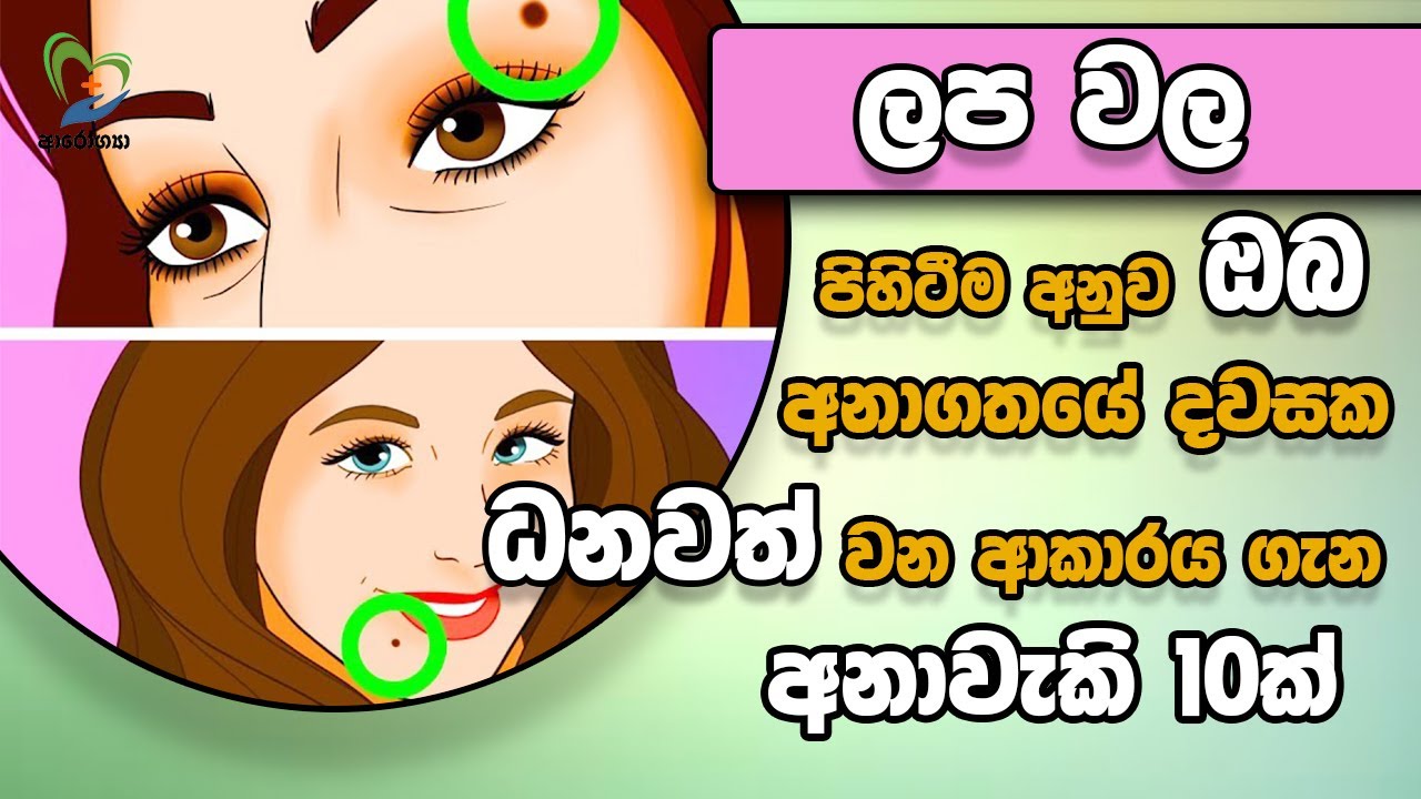 ලප වල පිහිටීම අනුව ඔබ අනාගතයේ දවසක ධනවත් වන ආකාරය ගැන අනාවැකි 10ක්