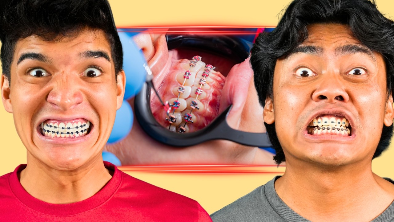 Alex and Roi Got Adult Braces?!