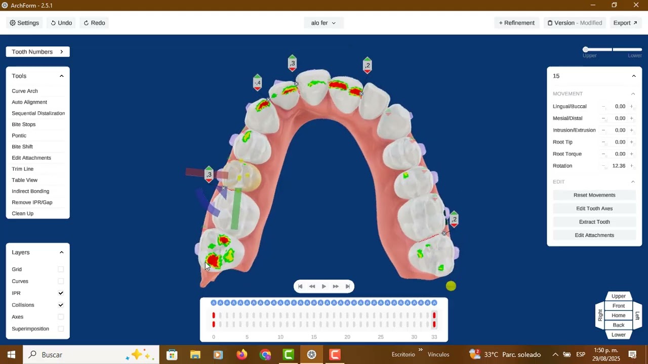 Arch Form 😎 un buen programa para desarrollar ortodoncia con alinedores 🦷