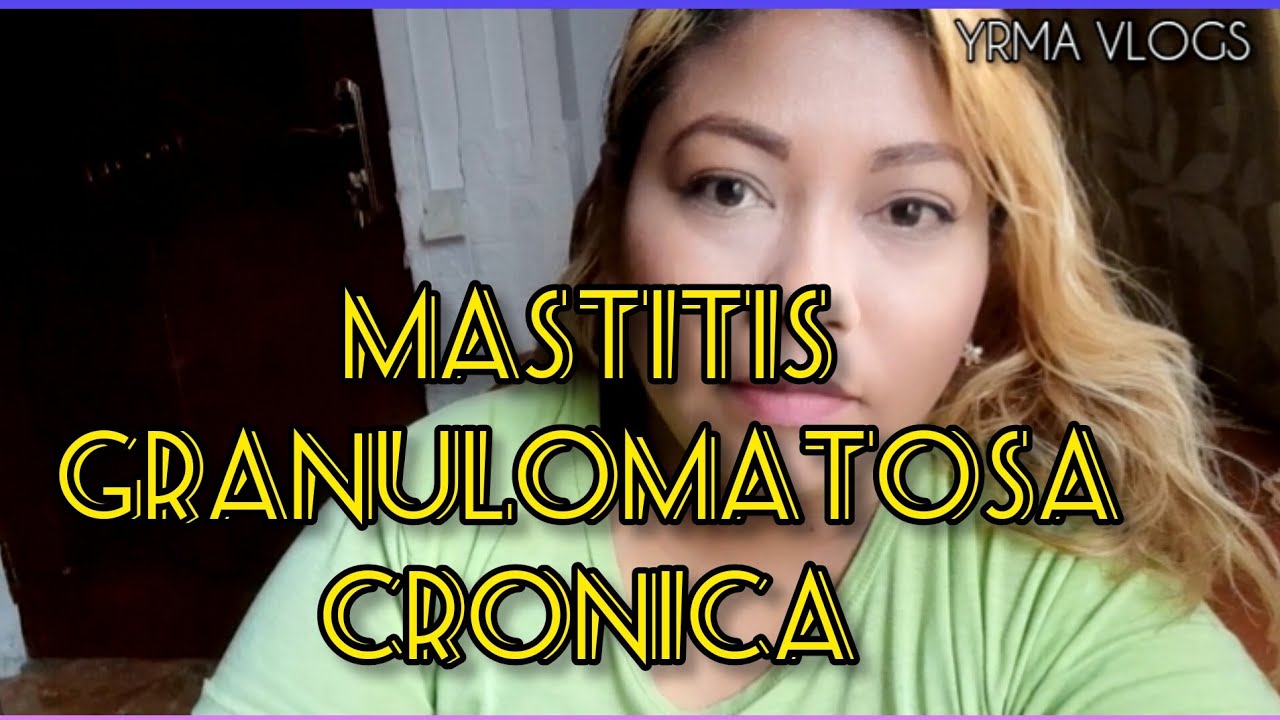 MI ENFERMEDAD | MASTITIS GRANULOMATOSA CRONICA