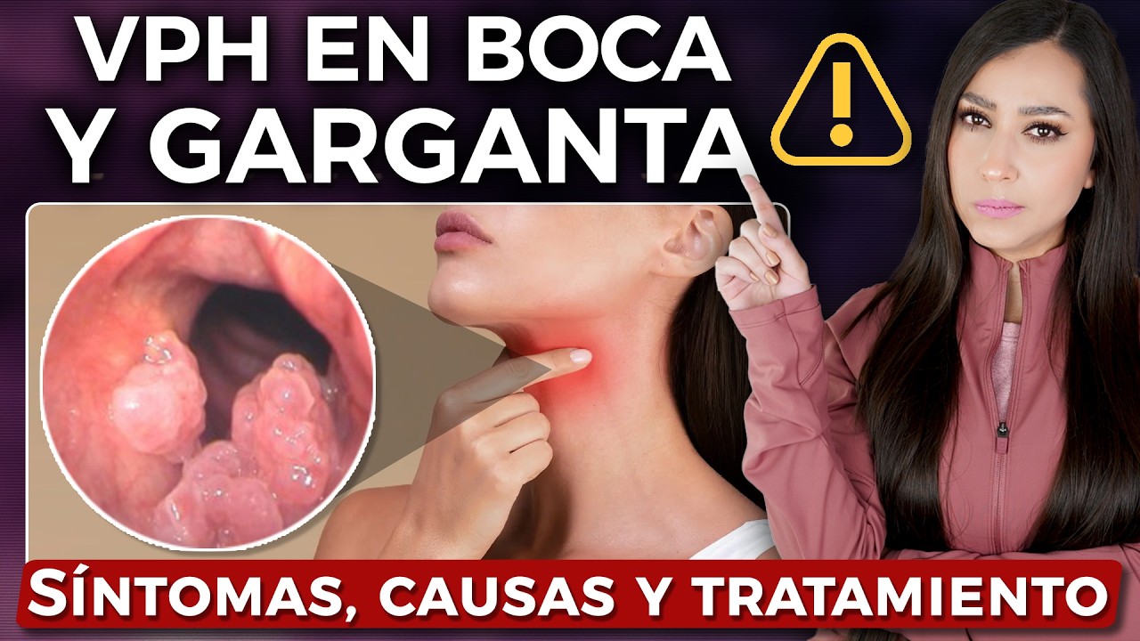 VPH Oral y Papilomatosis Laríngea: Causas, Síntomas y Prevención Efectiva👩🏻‍⚕️ @Dra. Pau Zúñiga