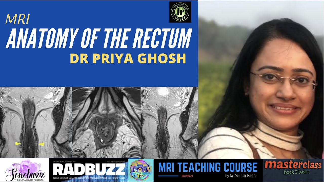 RECTAL ANATOMY ON MRI  | DR PRIYA GHOSH | MRI RECTUM | RECTAL WALL