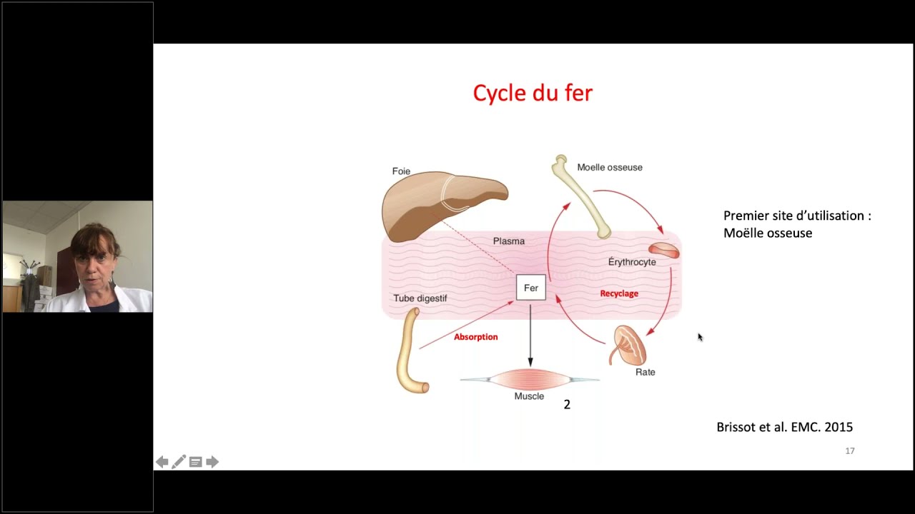 DES Hématologie 2020-2021 : Pathologies du fer (1/2)