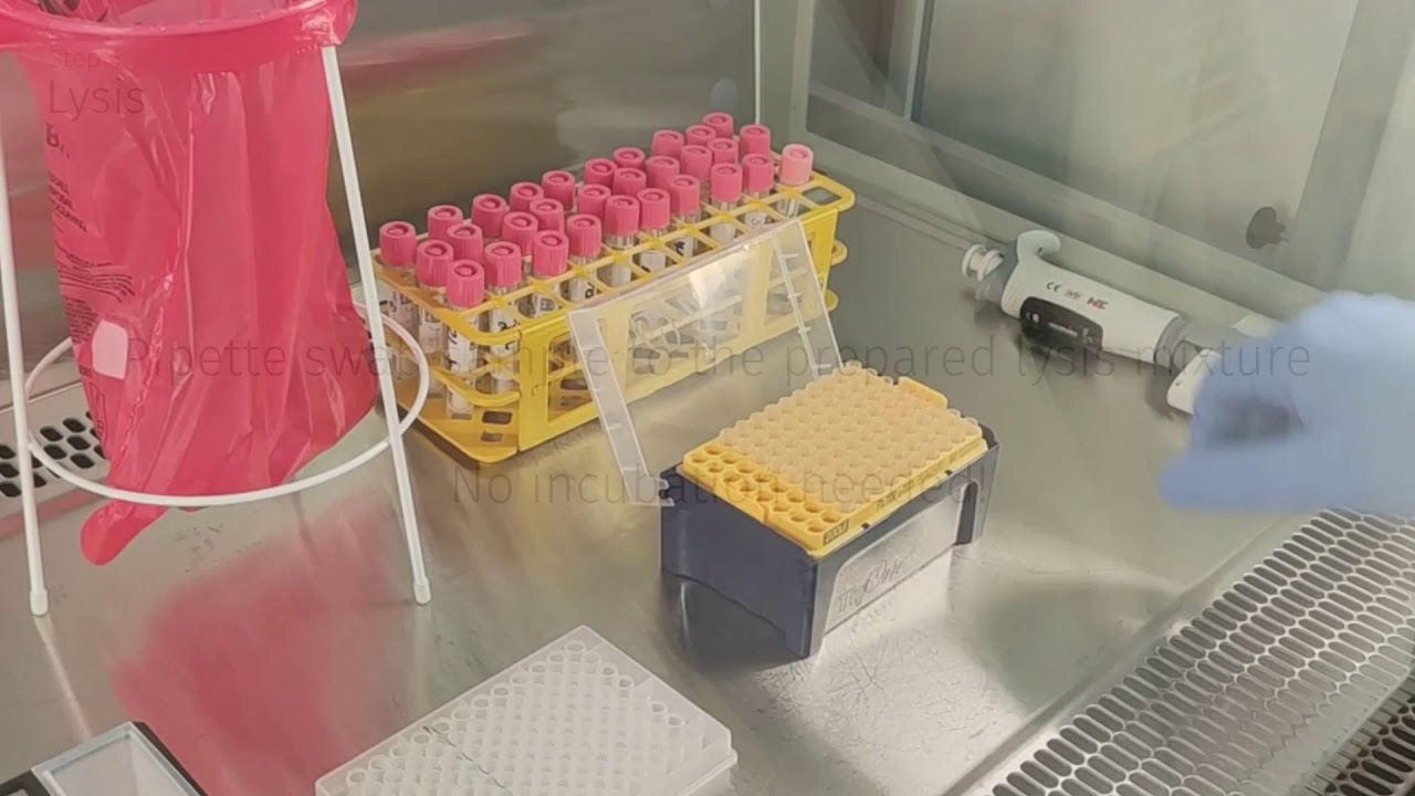BioEcho&rsquo;s single-step viral RNA extraction Kit for faster COVID-19 testing