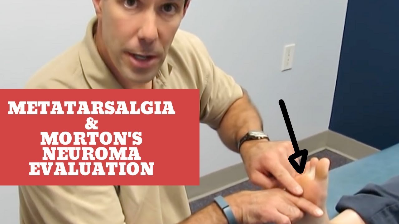 Metatarsalgia and Morton's Neuroma (Evaluation and Treatment)