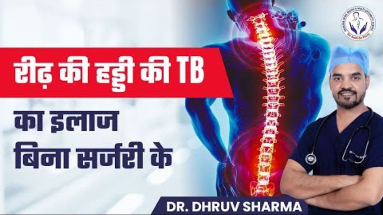 Spine TB (Bone TB) Treatment Without Surgery | Expert Advice by Dr. Dhruv Sharma
