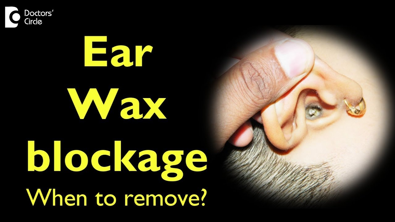 Ear Wax blockage - When to remove? - Dr. Sheelu Srinivas