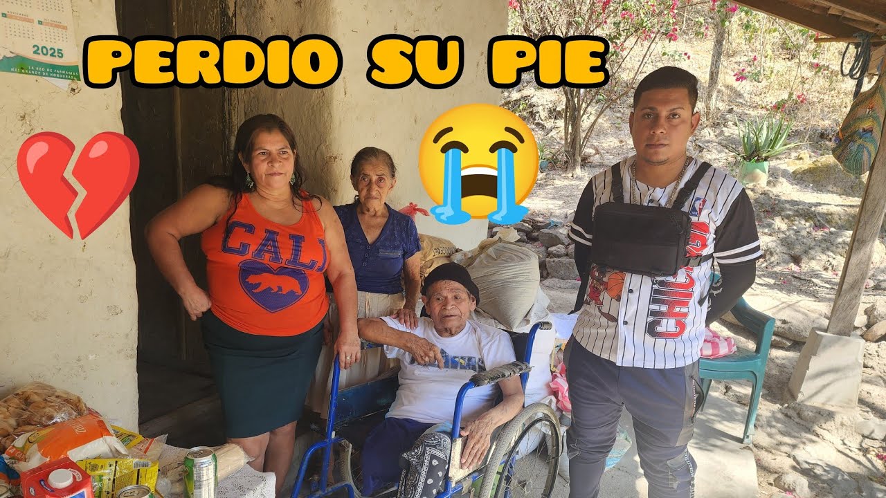 Don Concepción perdió su pie 😢 | Historia que necesita apoyo en San Lucas, Camasca Intibucá 🙏