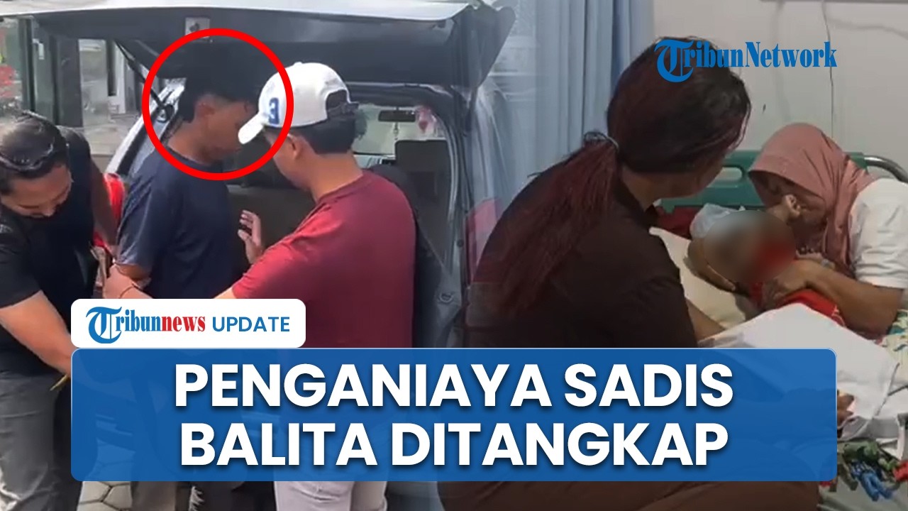 Balita di Karawang Dianiaya Pacar Ibunya Pakai Tang hingga Lidah Robek, Pelaku Ditangkap