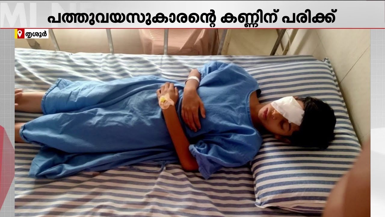 ഗുരുവായൂർ ക്ഷേത്രത്തിൽ ദർശനം നടത്തി പുറത്തിറങ്ങിയ കുട്ടിക്ക് ബാരിക്കേഡിൽ തട്ടി പരിക്ക്
