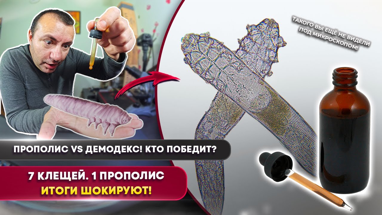 Прополис против клеща Демодекс 🐜🔥 Полный эксперимент под микроскопом | Демодекс | Прополис тест
