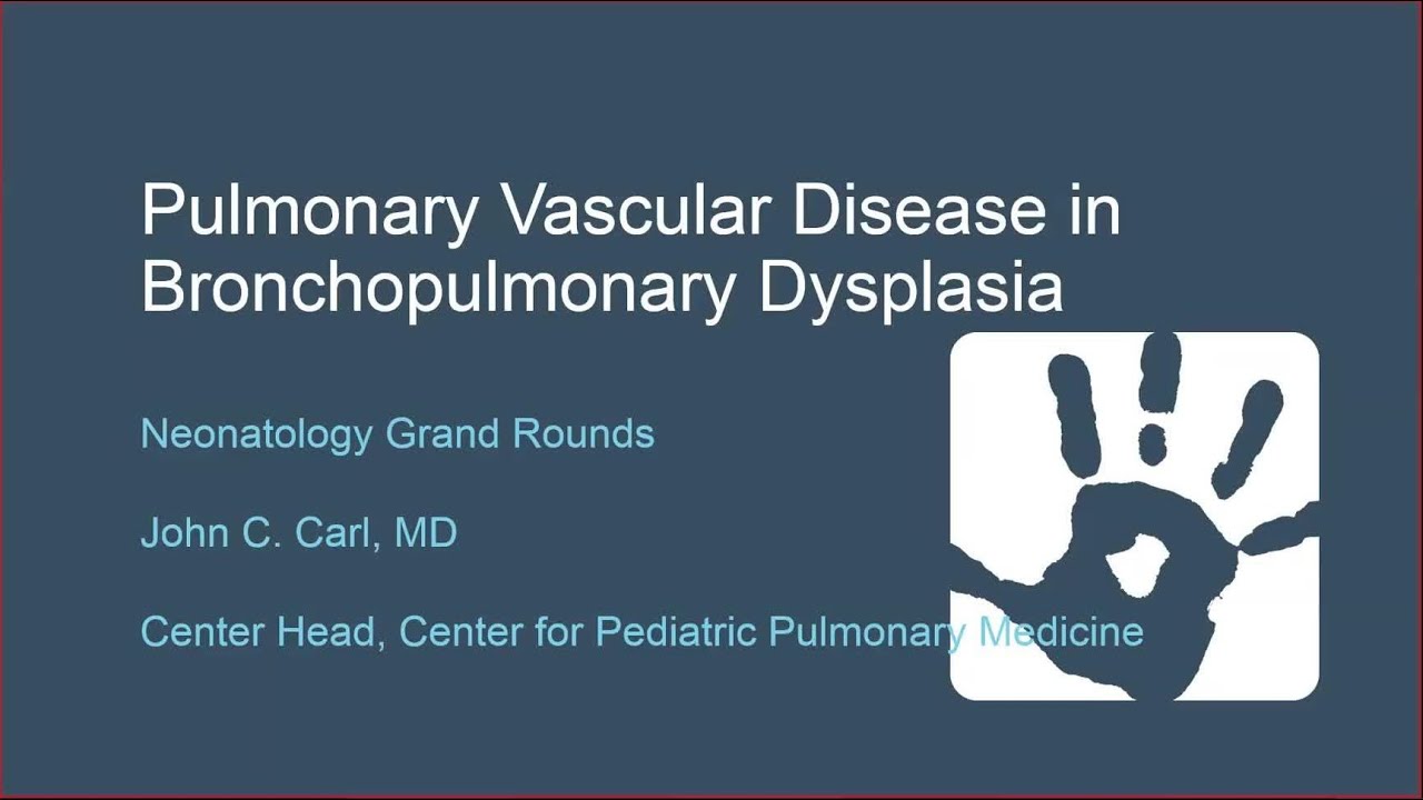 Pulmonary Vascular Disease in Bronchopulmonary Dysplasia: Moving From Acute to Chronic Management