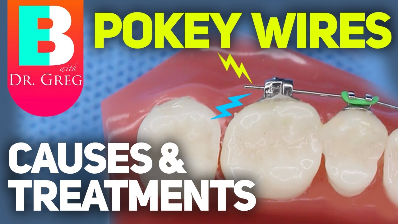 Pokey Wire / Braces Pain: Causes and Fixes