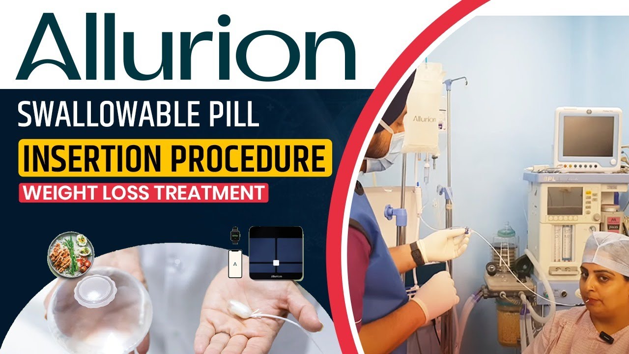 Allurion Gastric Balloon Live | Swallow Pill Weight Loss Balloon | Patient Review | Before and After