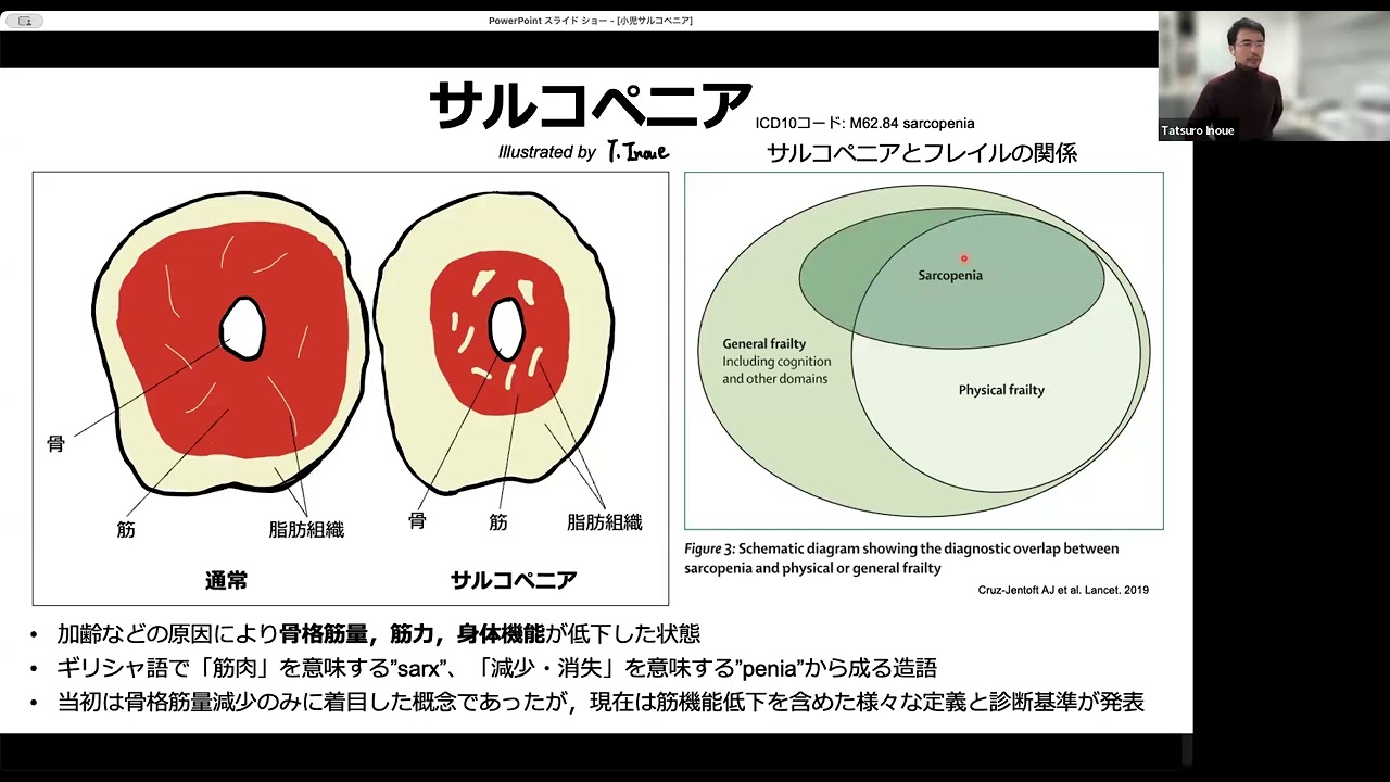 第63回小児栄養オンラインサロン　その２