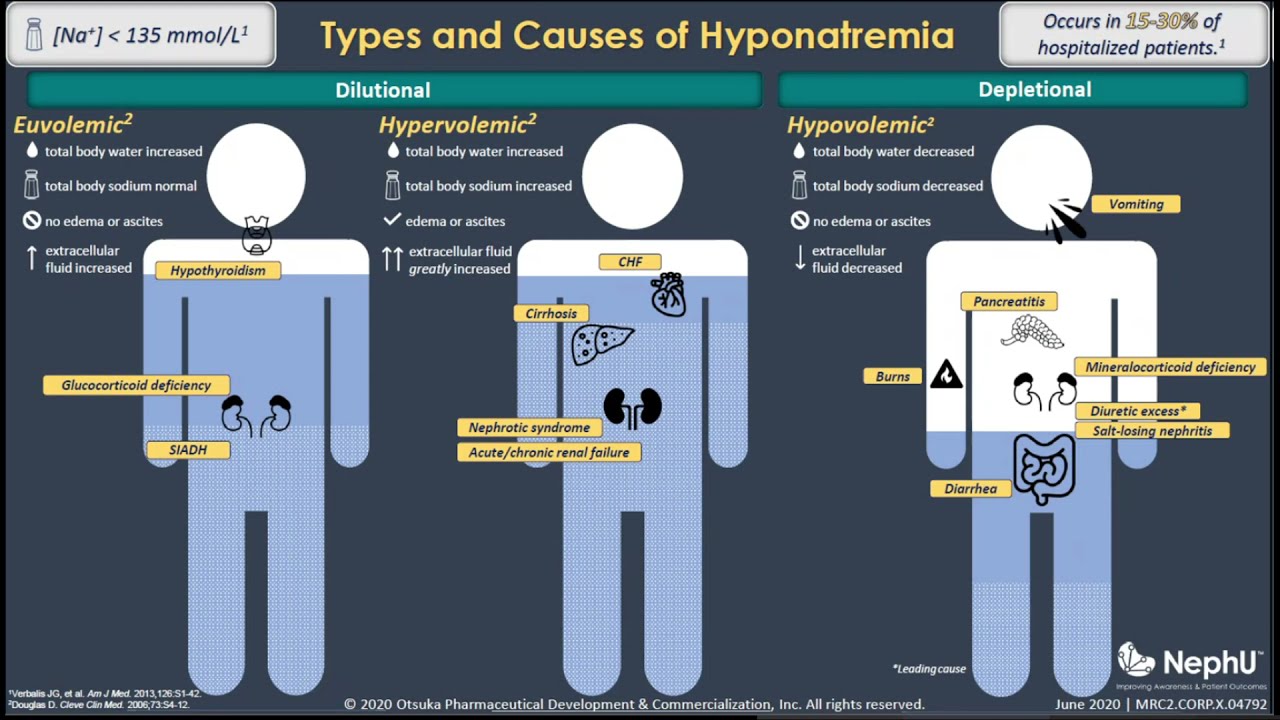 NephU - Classification & Diagnostic Criteria of Hyponatremia