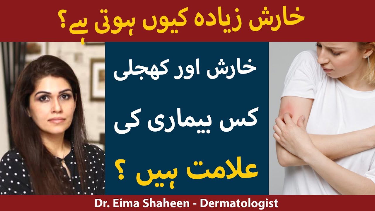 Kharish خارش (Itching) Khujli کھجلی Ka Fori Ilaj |  خارش کا علاج | Kharish Khatam Karne Ka Tarika
