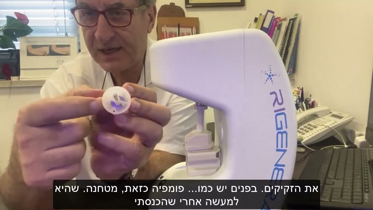 טיפול בשיער דליל באמצעות זקיקי שיער מהמטופל - ריגנרה RIGENERA - ד