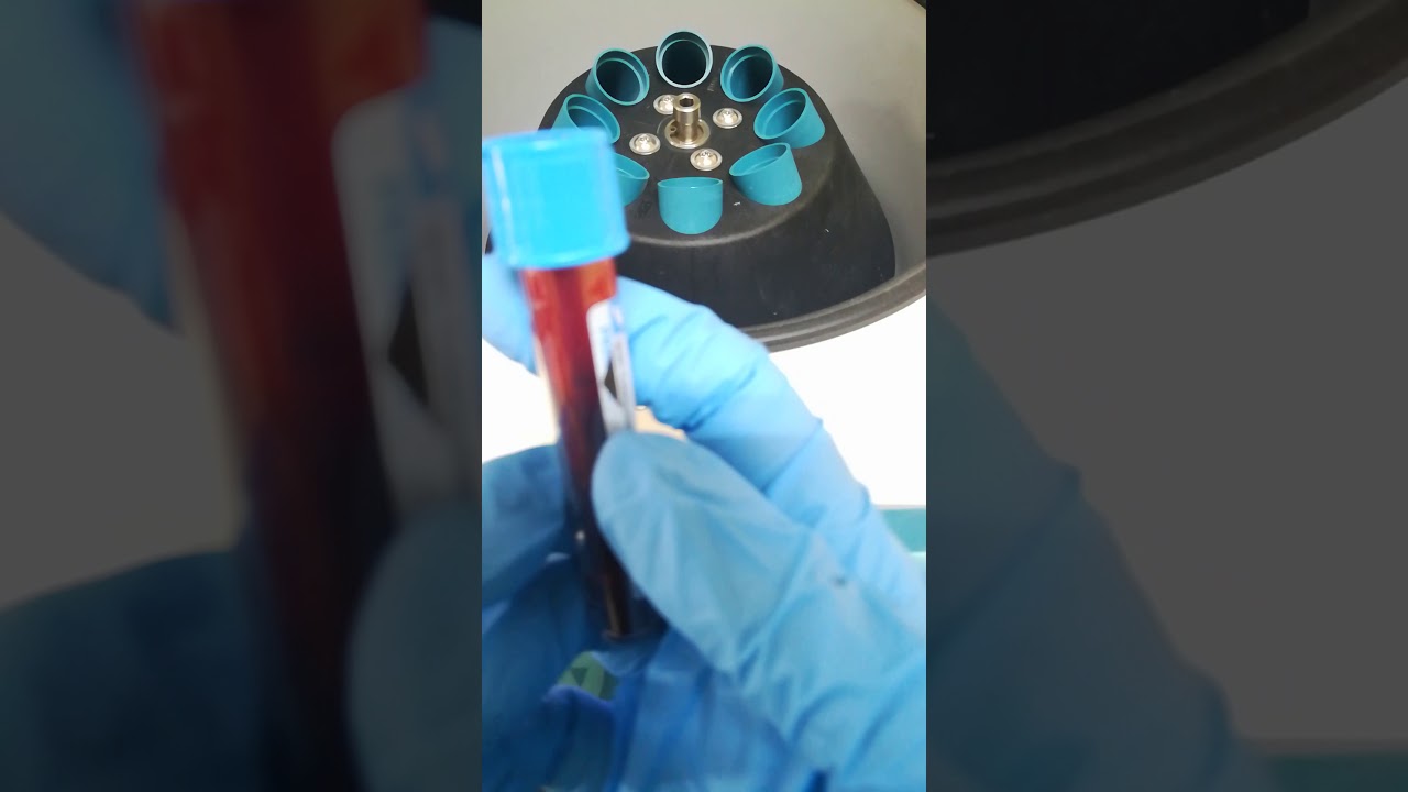 طريقة إجراء تحليل pt ptt الجزء الأول