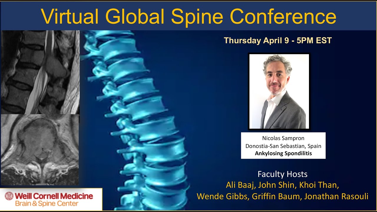 Ankylosing Spondylitis by Dr. Nicolas Sampron