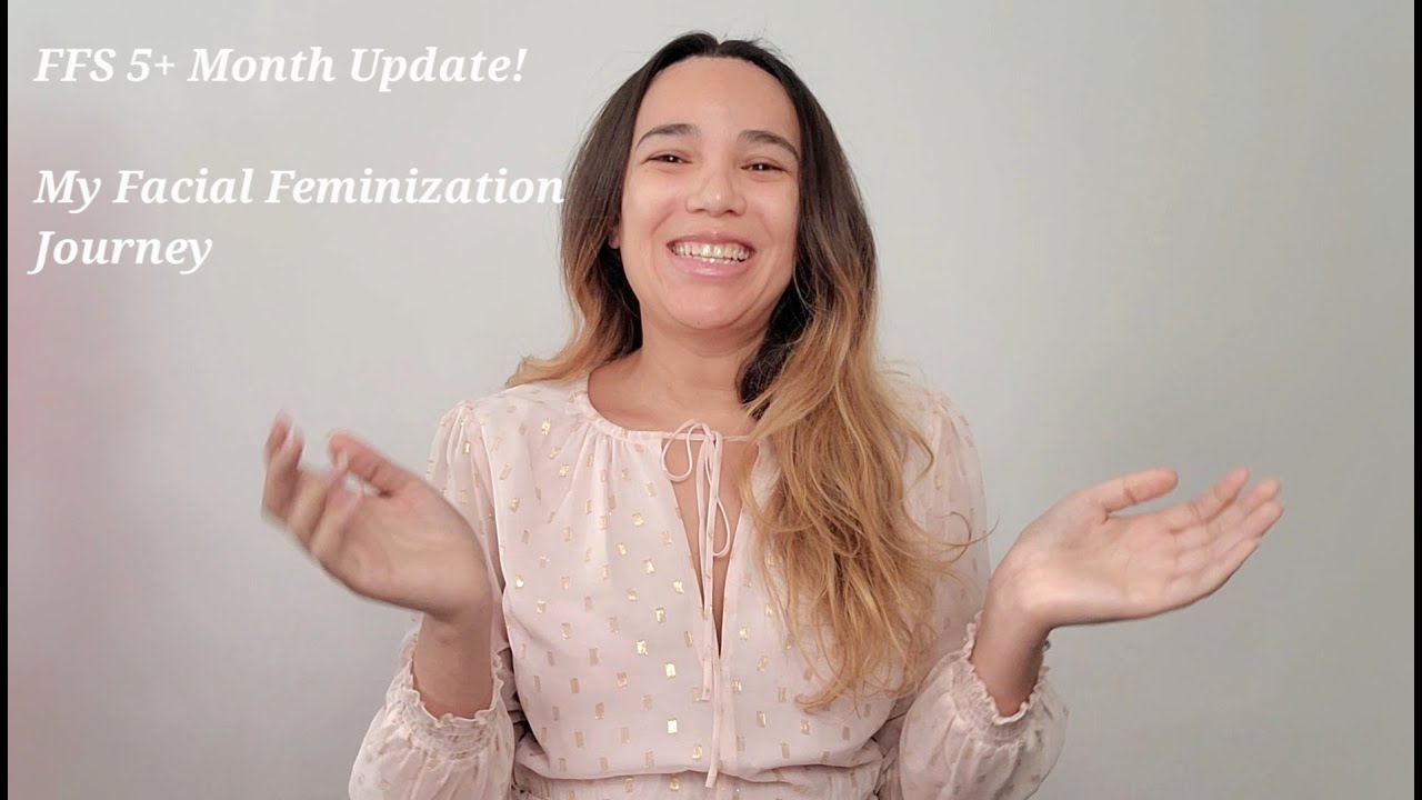FFS 5+ Month Post Op Update - FFS With Dr. James Bradley at Lenox Hill Hospital/Northwell Health