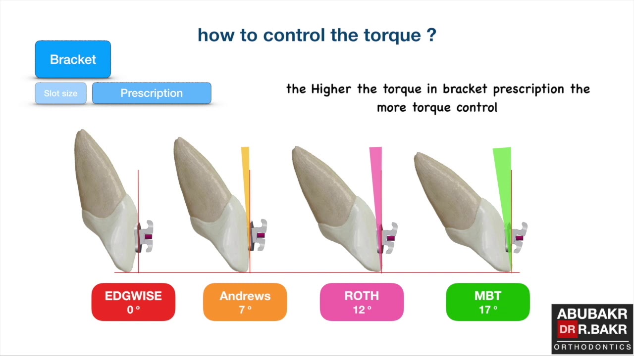 II) How to control torque during retraction, part I ?
