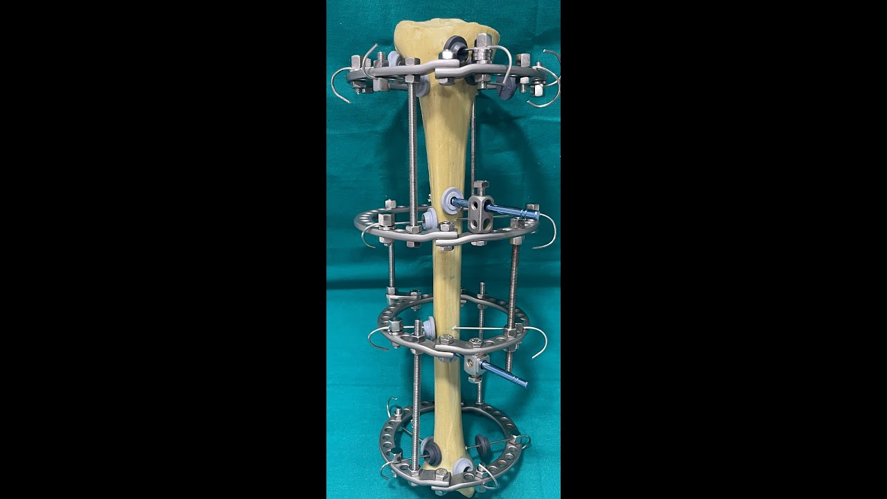 Wire pin insertion on bone model