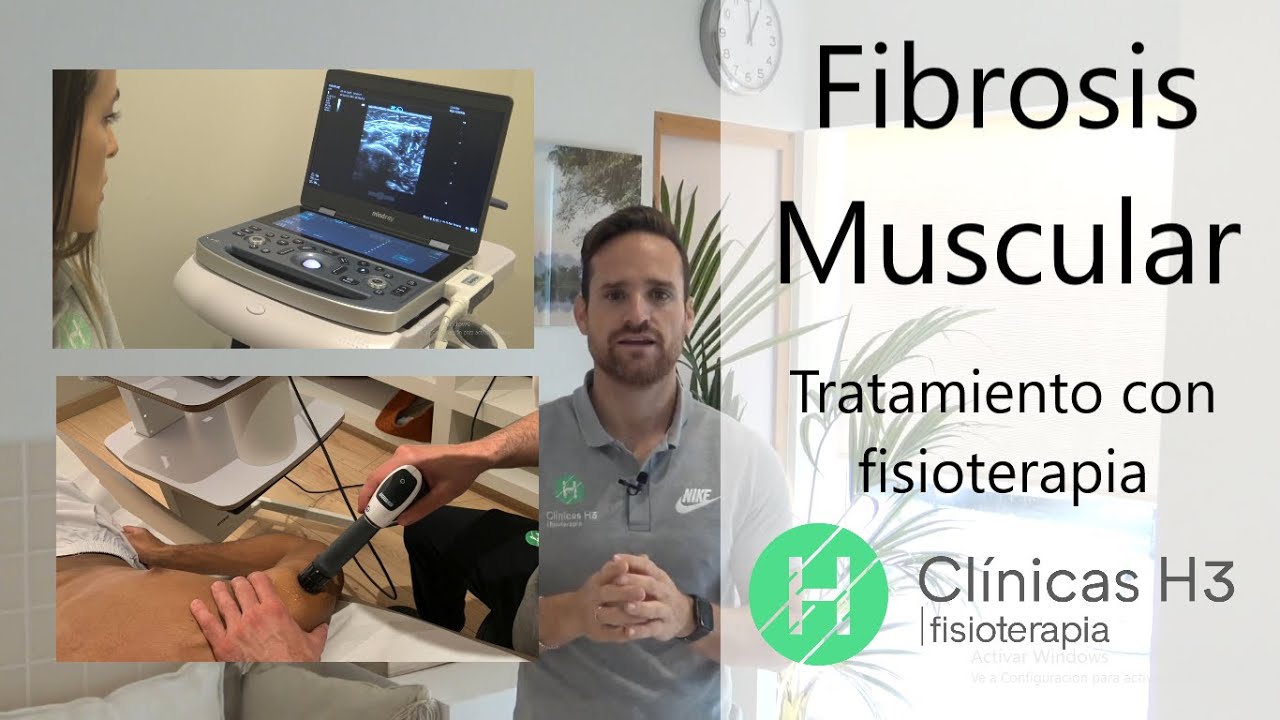 Fibrosis muscular &iquest;Qu&eacute; es? &iquest;Cu&aacute;l es el mejor tratamiento? | Clinicas h3 fisioterapia