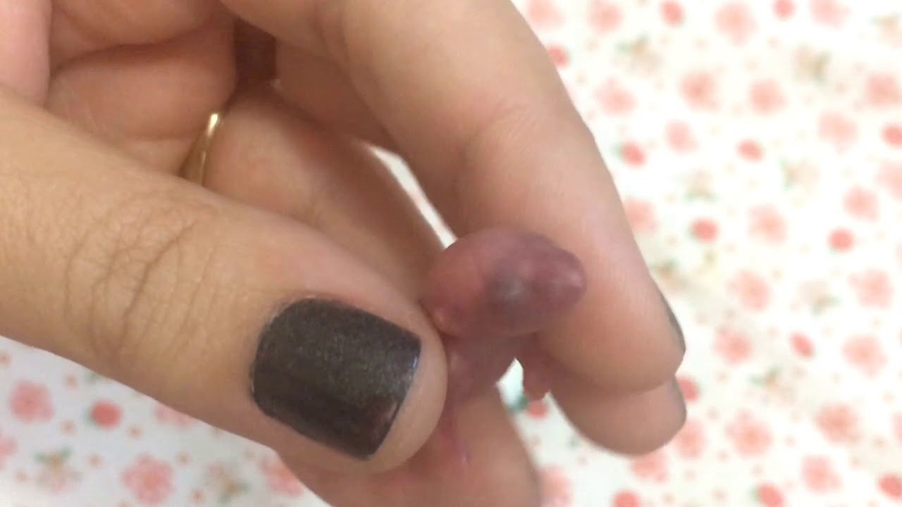SOBREVIVEU - Dando leite para filhote que não estava mamando