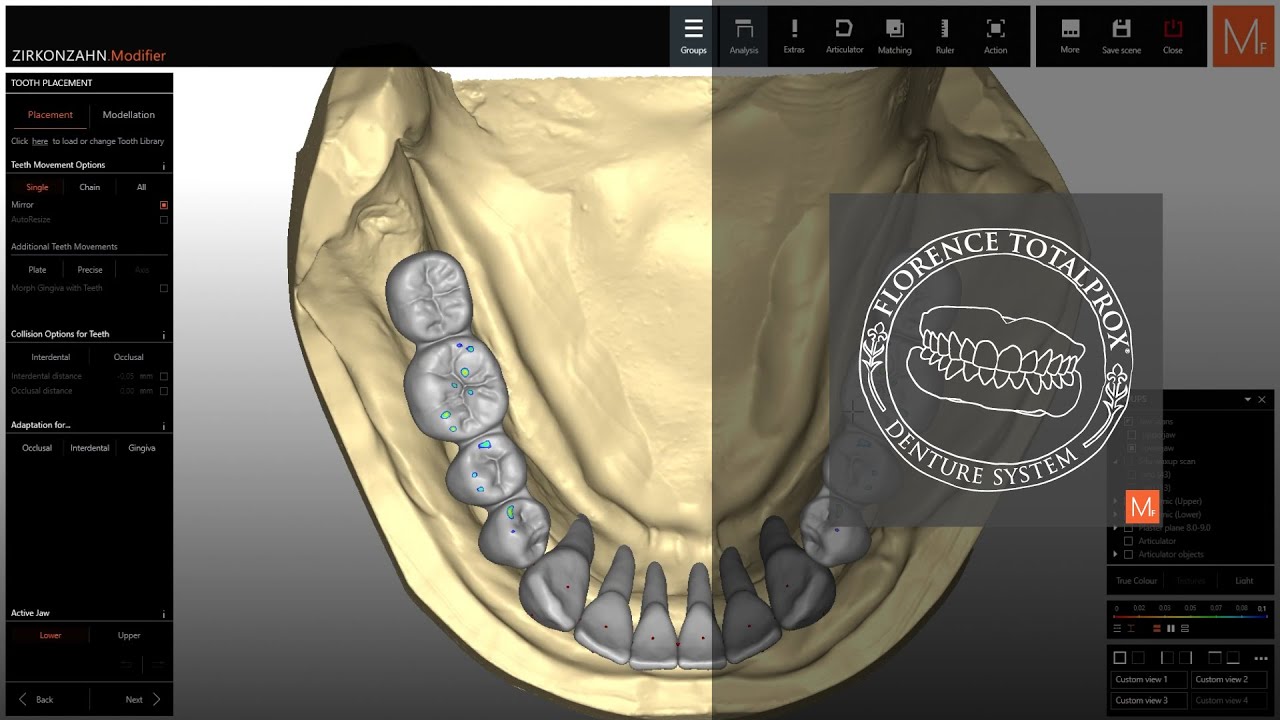 Una biblioteca. Control total. | Zirkonzahn.Modifier