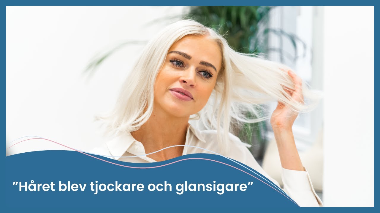 Frida gör PRP-behandling mot tunt hår | Nordic Hair