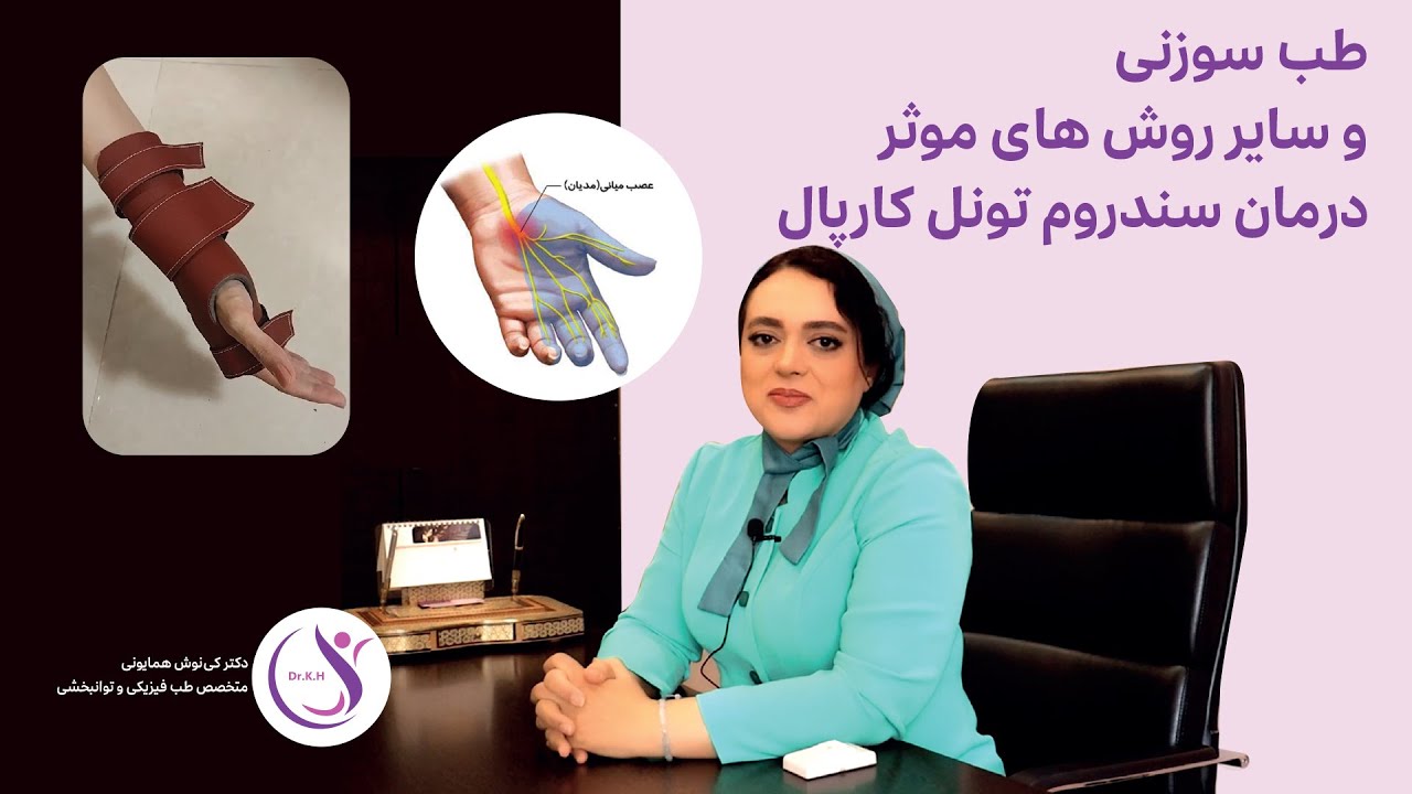 درمان کارپال تونل (CTS) بدون جراحی | تجربه بالینی و راهکارهای موثر