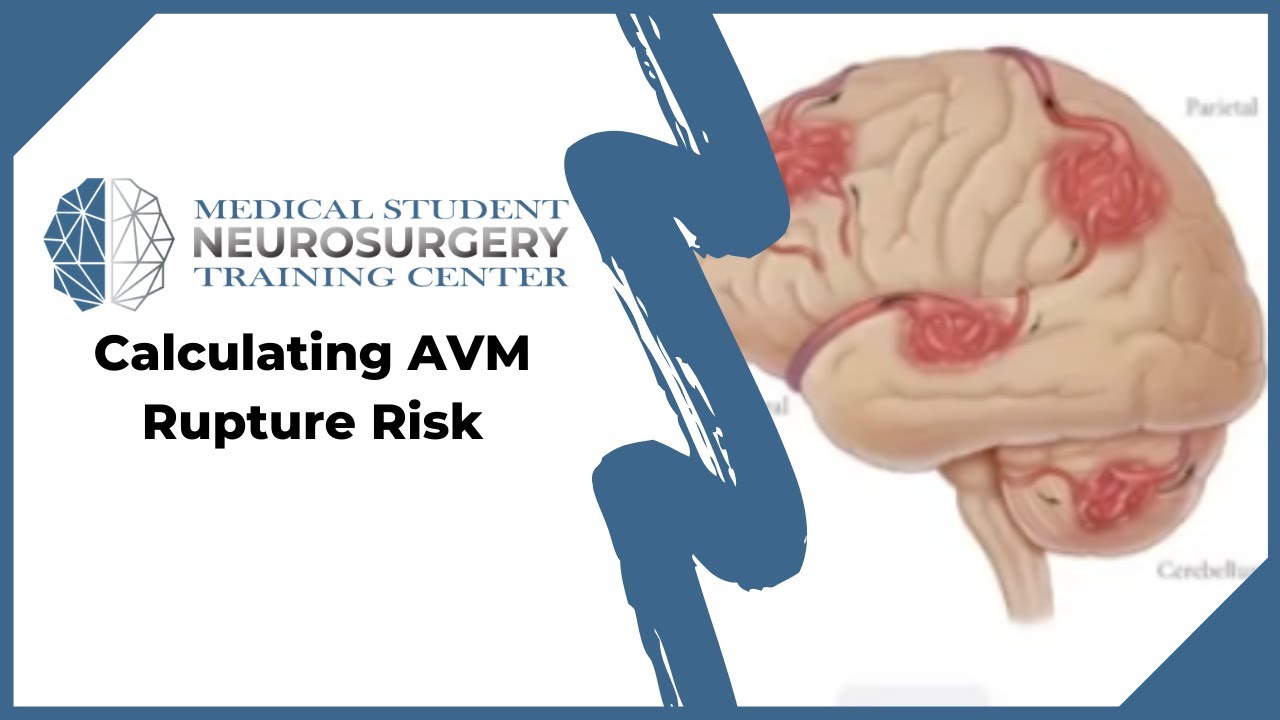 Calculating AVM Rupture Risk