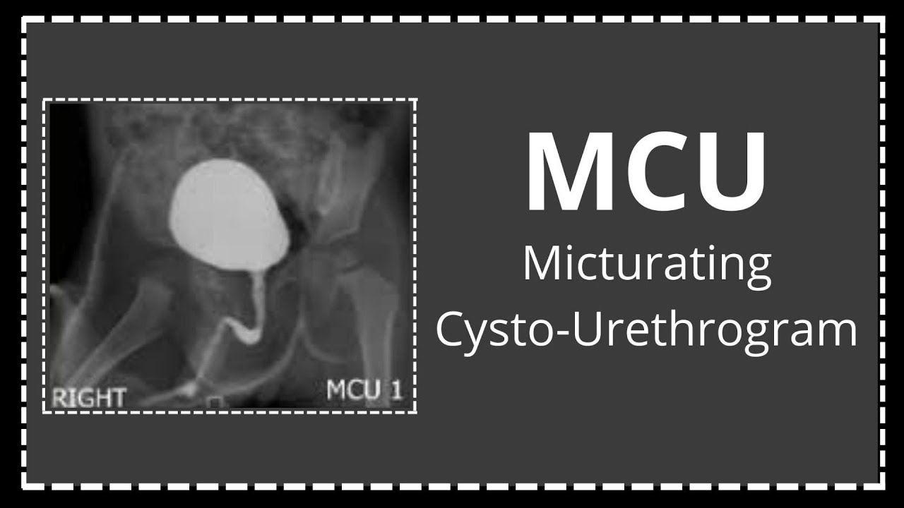 MCU procedure in radiology