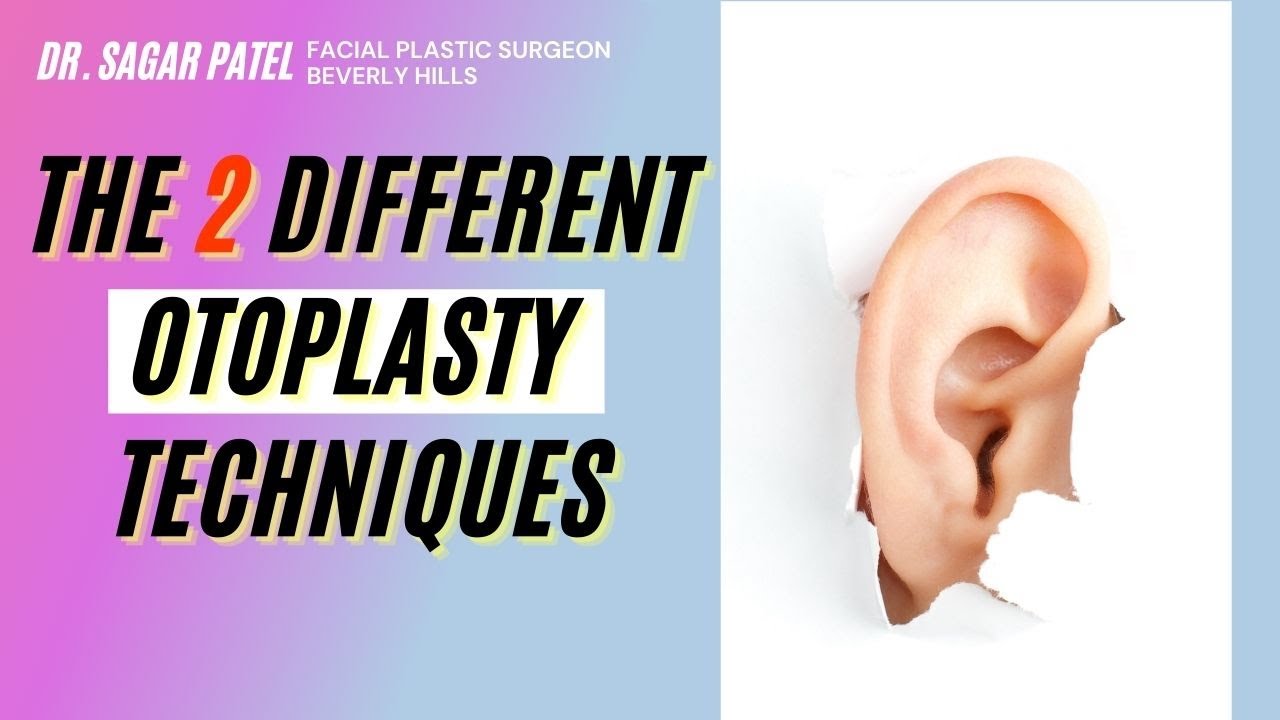 The 2 Different Otoplasty Techniques!
