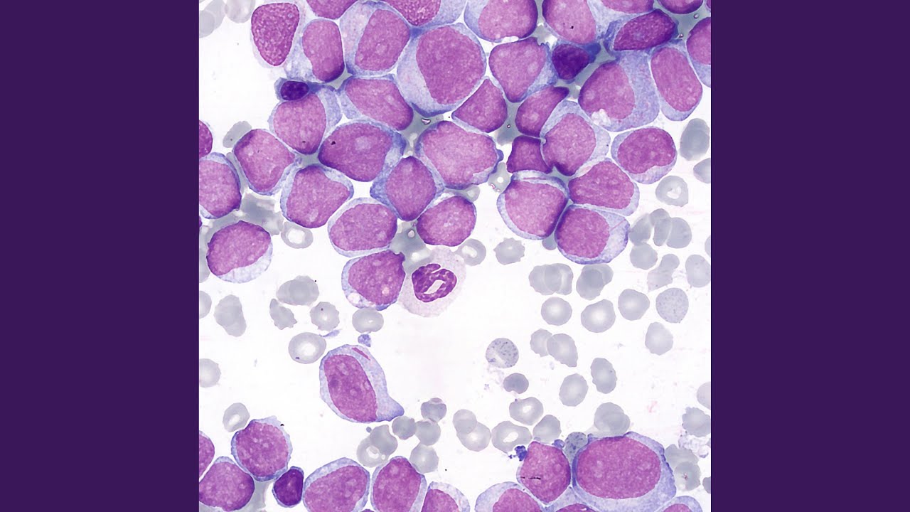 aml 101 2 0818