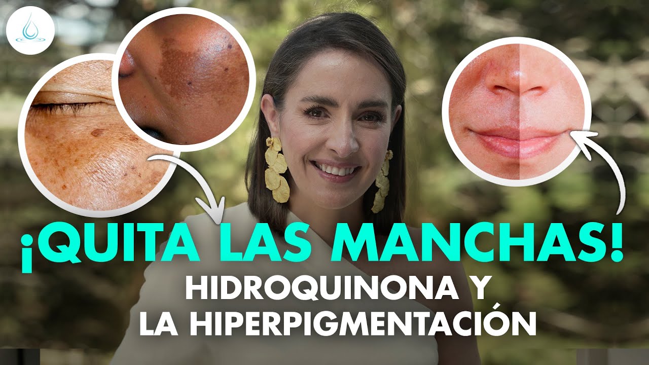 🔴 HIDROQUINONA ¿MILAGROSA? Como Funciona y Efectos Secundarios @drapilarochoa - Dermatologa