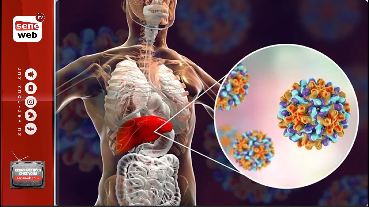 Tout savoir sur l'Hépatite B
