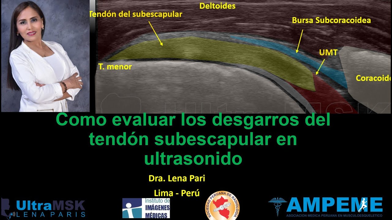 COMO EVALUAR LOS DESGARROS DEL TENDÓN SUBESCAPULAR. DRA LENA PARI