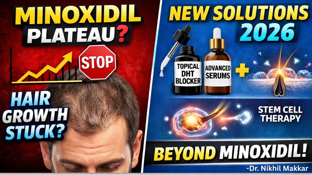 Hair Loss Treatment 2026 🔥 Minoxidil Plateau + Topical Finasteride/Dutasteride Explained