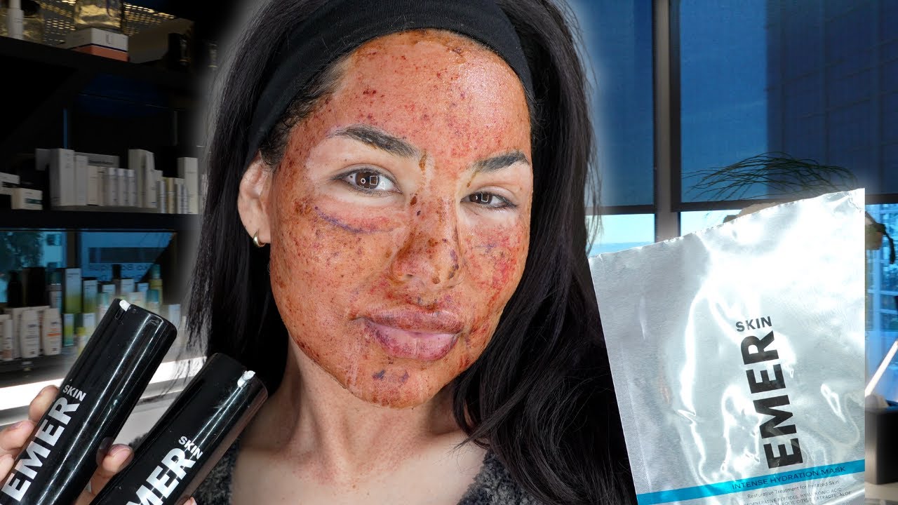 Laser Skin Treatment Q&A