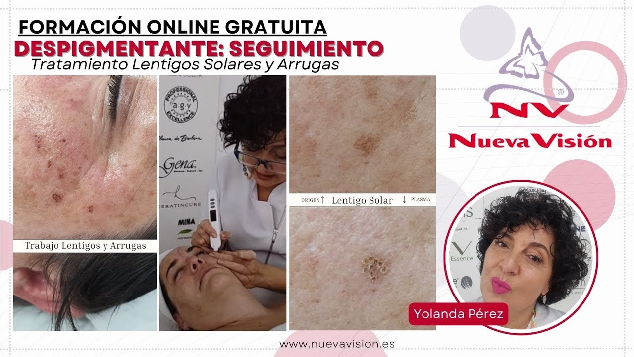 Despigmentación y Anti Ageing: sesión de seguimiento