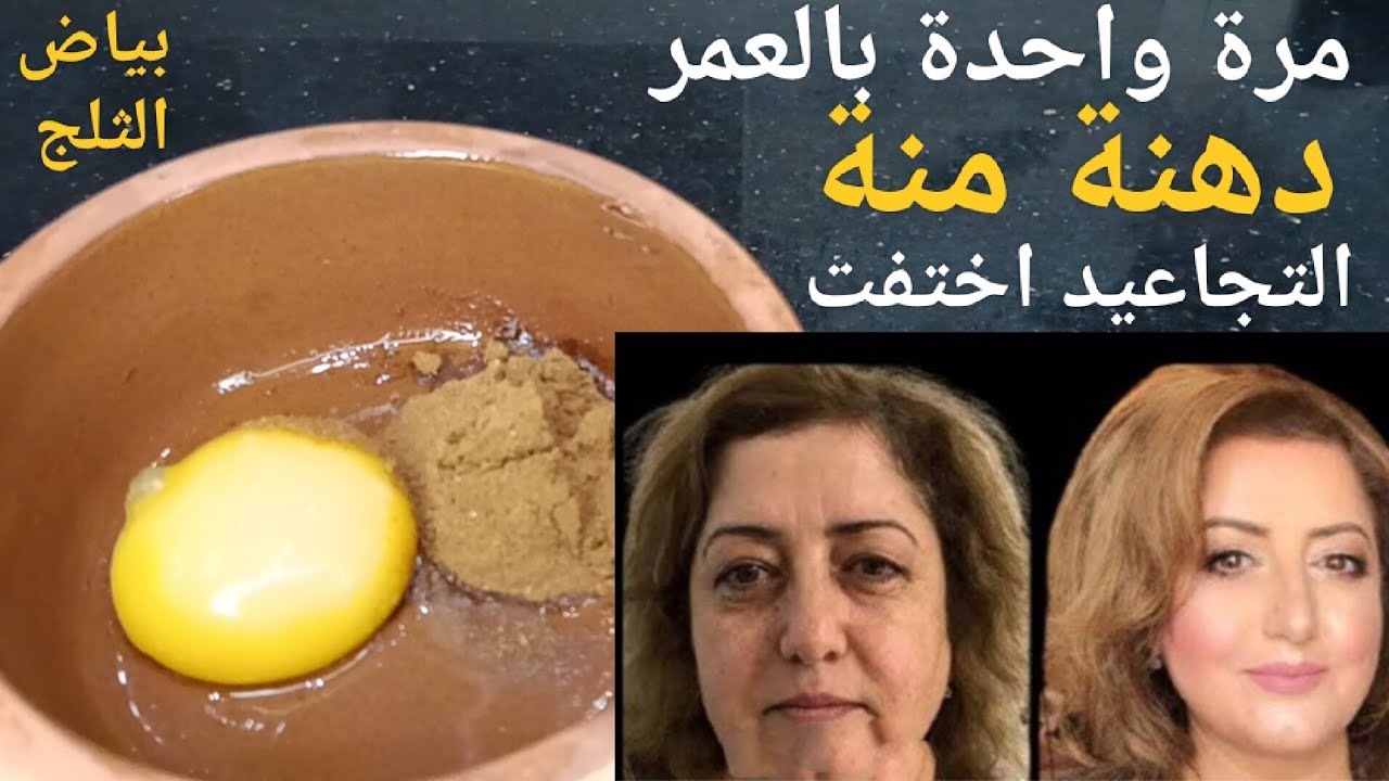 أنا مسؤولة عن كلامى, حتى لو عمرك 60سنة ضعيها على التجاعيد وستختفى فوراسيجعل وجهك ابيض مشدودكأنك شابة