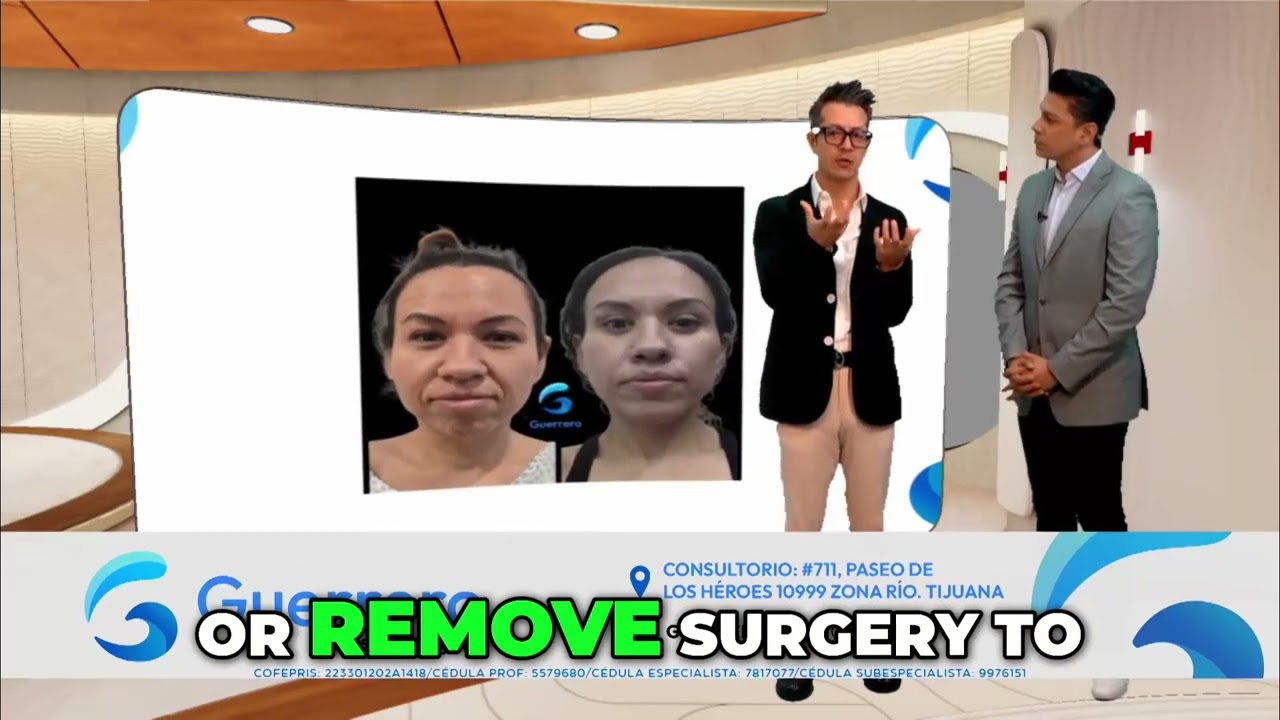 Post Weight Loss Surgery  - Guerrero Plastic Surgery - Entrevista TV Azteca