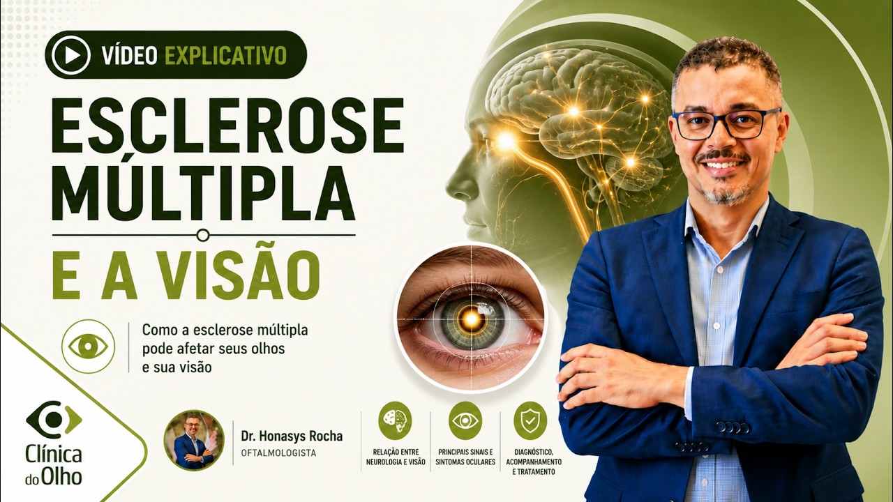 Esclerose Múltipla e Visão: O Risco do Edema Macular por Fingolimode (Gilenya)