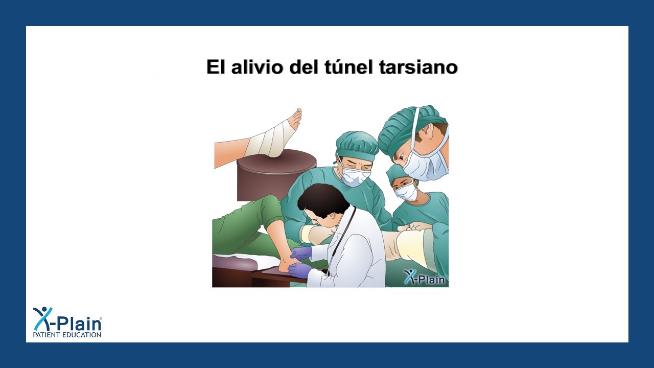 El alivio del túnel tarsiano